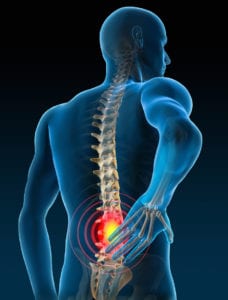 x-ray medical illustration showing targeted Chronic Spinal Pain