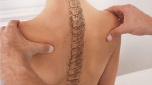 Scoliosis examination. with spinal bone illustration