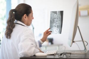 Doctor Reviewing X-ray Results