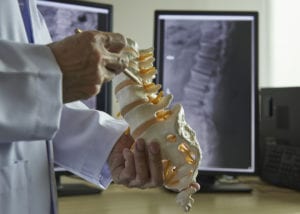 A neurosurgeon using pencil pointing at lumbar vertebra model in medical office. Lumbar spine x-ray on computer screen on background.