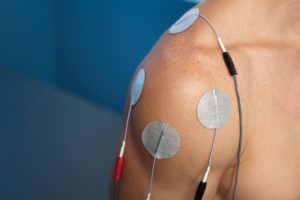 Patient receiving shoulder electrical stimulation