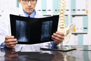 orthopedic doctor checking neck X-ray
