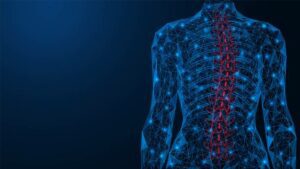 Scoliosis, curvature of the spine. Incorrect deformation of the human back. Polygonal design of interconnected lines and points. Blue background.