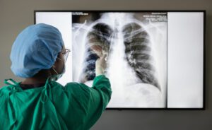 Spine surgeon looking at chest x ray