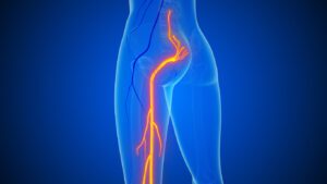 nerve pain illustration