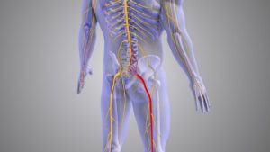 3D illustration of Sciatic nerve pain medical concept.