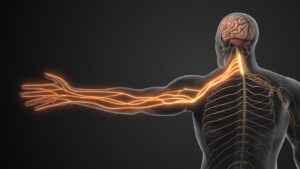 3D illustration showing Nerve Compression in Neck Causing Radiculopathy .