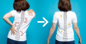 Scoliosis treatment showing a woman's body and backbone go from bad posture to good posture.